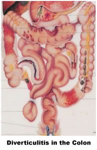 colon_sm.jpg