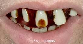 teeth.jpg