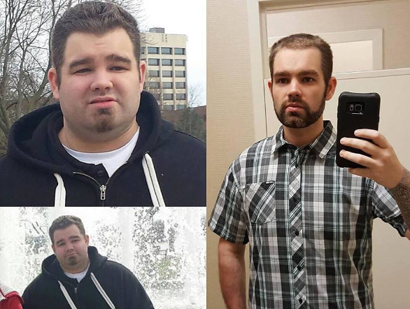 hcg complex before and after photo man 