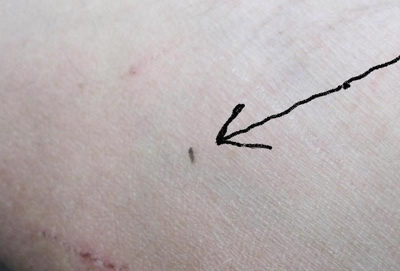 sandfly2.jpg